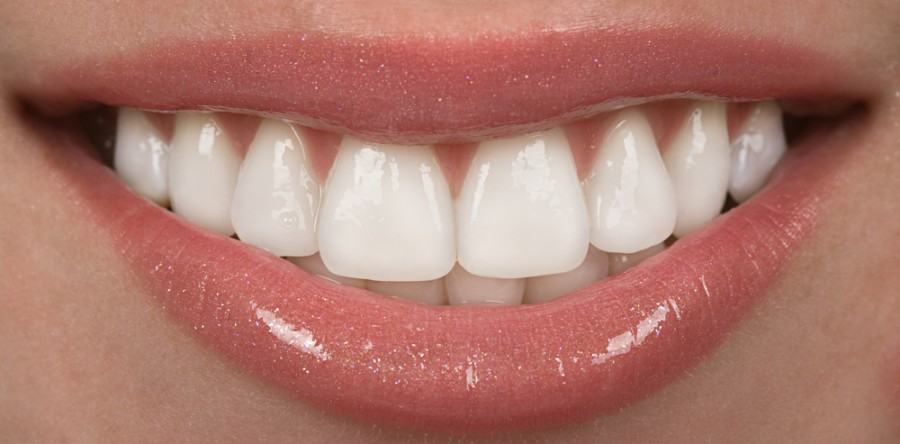 Woman's healthy smile