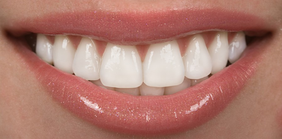 Woman's healthy smile
