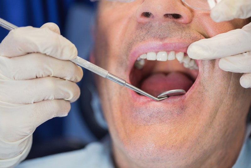 Man receiving a dental exam